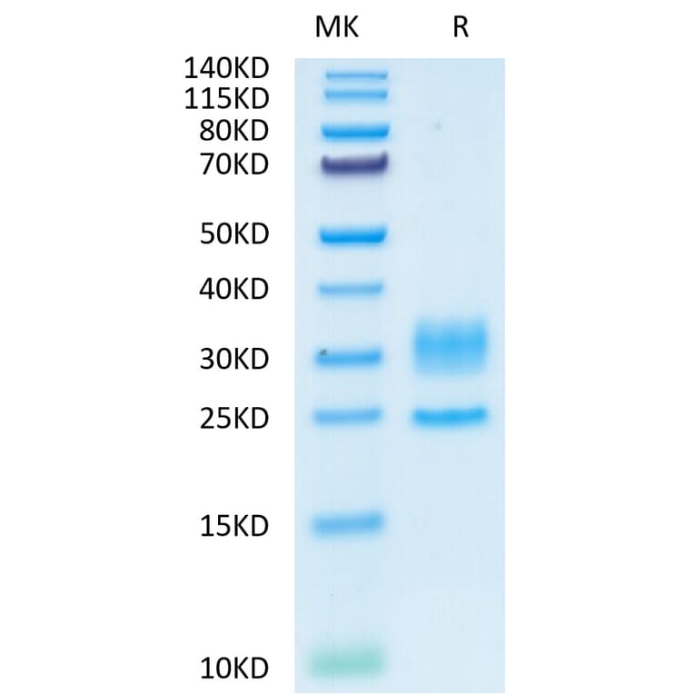Tris-Bis PAGE - Recombinant Human CD3 + CD3d Protein (C-terminal His Tag) (A330302) - Antibodies.com