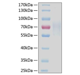 SDS-PAGE - Recombinant Human CD30 Protein (C-terminal His Tag) (A330303) - Antibodies.com