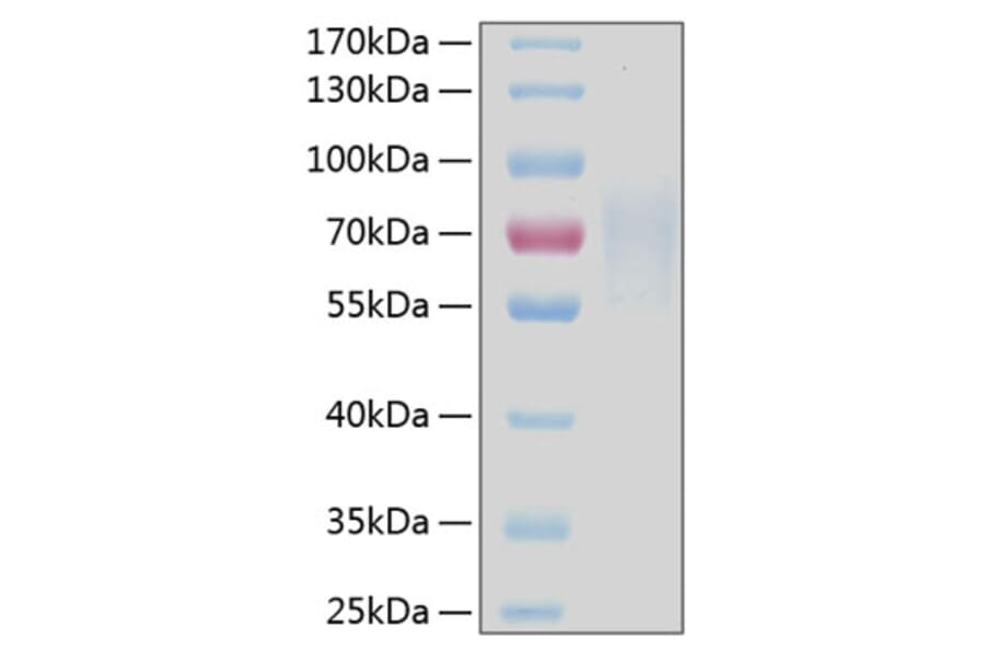 SDS-PAGE - Recombinant Human CD30 Protein (C-terminal His Tag) (A330303) - Antibodies.com