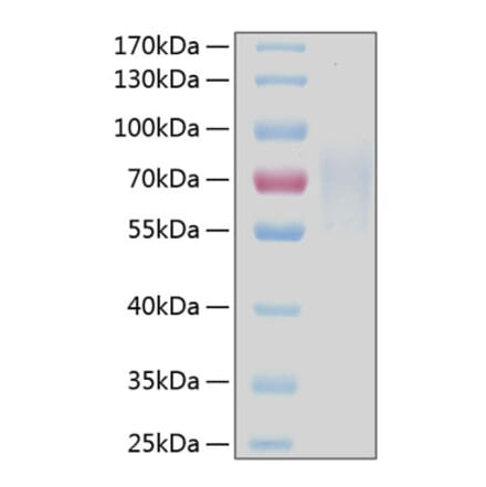 SDS-PAGE - Recombinant Human CD30 Protein (C-terminal His Tag) (A330303) - Antibodies.com