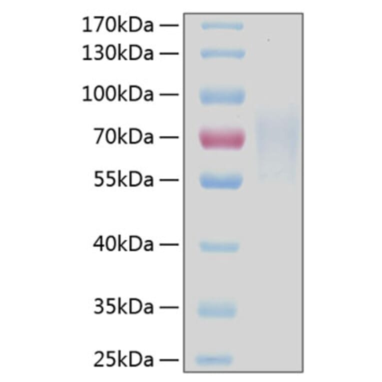 SDS-PAGE - Recombinant Human CD30 Protein (C-terminal His Tag) (A330303) - Antibodies.com