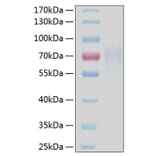 SDS-PAGE - Recombinant Human CD30 Protein (C-terminal His Tag) (A330303) - Antibodies.com