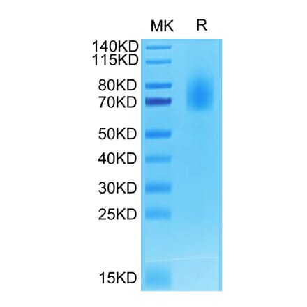 Tris-Bis PAGE - Recombinant Human CD30 Protein (Biotin) (C-terminal His and Avi Tag) (A330304) - Antibodies.com