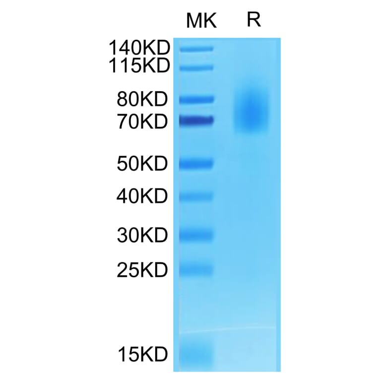 Tris-Bis PAGE - Recombinant Human CD30 Protein (Biotin) (C-terminal His and Avi Tag) (A330304) - Antibodies.com