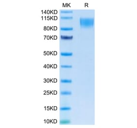 Tris-Bis PAGE - Recombinant Human CD30 Protein (C-terminal Human Fc Tag) (A330305) - Antibodies.com