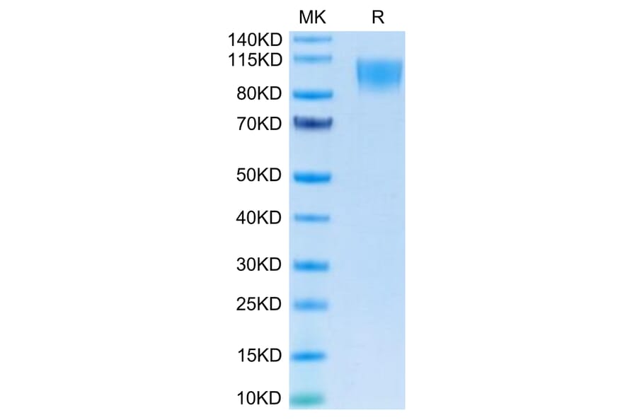 Tris-Bis PAGE - Recombinant Human CD30 Protein (C-terminal Human Fc Tag) (A330305) - Antibodies.com
