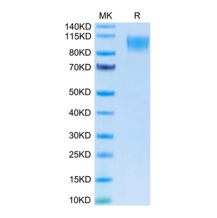 Tris-Bis PAGE - Recombinant Human CD30 Protein (C-terminal Human Fc Tag) (A330305) - Antibodies.com