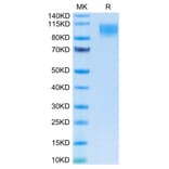 Tris-Bis PAGE - Recombinant Human CD30 Protein (C-terminal Human Fc Tag) (A330305) - Antibodies.com