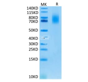 Tris-Bis PAGE - Recombinant Human CD30 Protein (C-terminal His and Avi Tag) (A330306) - Antibodies.com