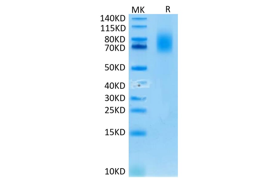 Tris-Bis PAGE - Recombinant Human CD30 Protein (C-terminal His and Avi Tag) (A330306) - Antibodies.com