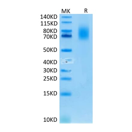 Tris-Bis PAGE - Recombinant Human CD30 Protein (C-terminal His and Avi Tag) (A330306) - Antibodies.com