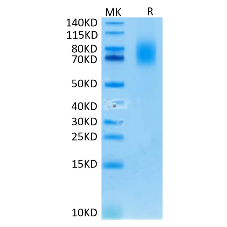 Tris-Bis PAGE - Recombinant Human CD30 Protein (C-terminal His and Avi Tag) (A330306) - Antibodies.com