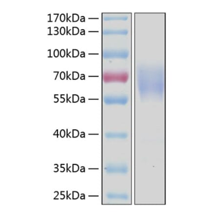 SDS-PAGE - Recombinant Human CD300a Protein (C-terminal Human Fc and His Tag) (A330307) - Antibodies.com