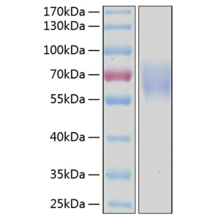 SDS-PAGE - Recombinant Human CD300a Protein (C-terminal Human Fc and His Tag) (A330307) - Antibodies.com