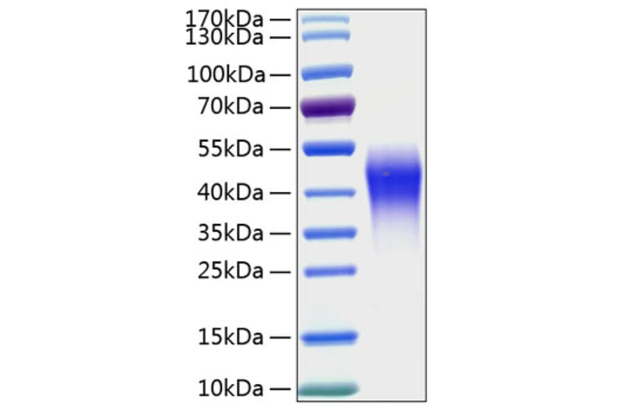 SDS-PAGE - Recombinant Human CD300c Protein (C-terminal His Tag) (A330308) - Antibodies.com