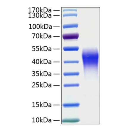 SDS-PAGE - Recombinant Human CD300c Protein (C-terminal His Tag) (A330308) - Antibodies.com