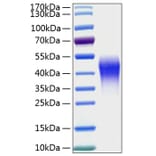 SDS-PAGE - Recombinant Human CD300c Protein (C-terminal His Tag) (A330308) - Antibodies.com