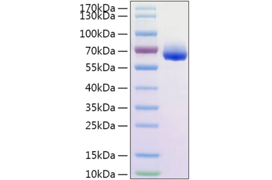SDS-PAGE - Recombinant Human CD300LG Protein (C-terminal His Tag) (A330309) - Antibodies.com