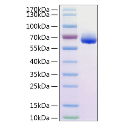 SDS-PAGE - Recombinant Human CD300LG Protein (C-terminal His Tag) (A330309) - Antibodies.com
