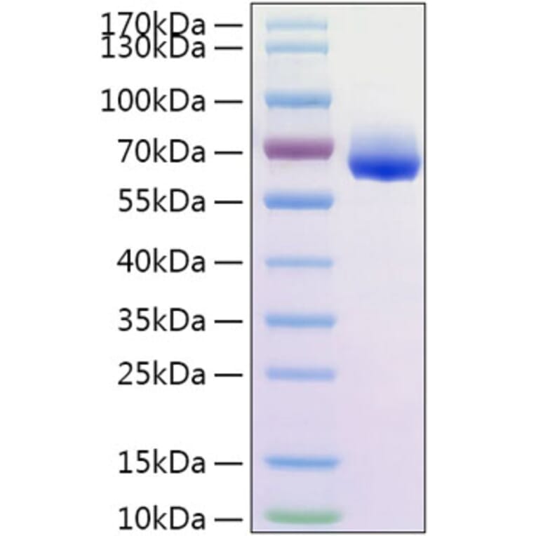 SDS-PAGE - Recombinant Human CD300LG Protein (C-terminal His Tag) (A330309) - Antibodies.com