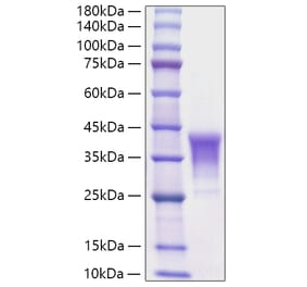 SDS-PAGE - Recombinant Human CD30-L Protein (N-terminal His Tag) (A330310) - Antibodies.com