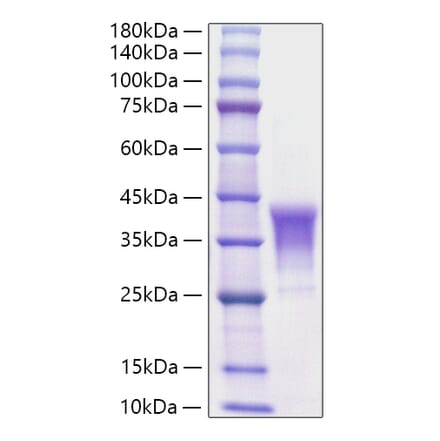 SDS-PAGE - Recombinant Human CD30-L Protein (N-terminal His Tag) (A330310) - Antibodies.com