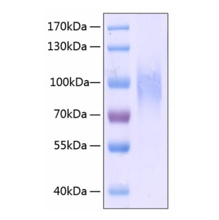 SDS-PAGE - Recombinant Human CD31 Protein (C-terminal His Tag) (A330311) - Antibodies.com