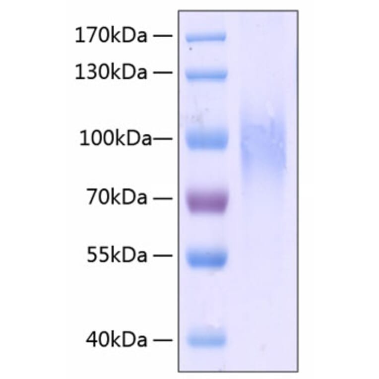 SDS-PAGE - Recombinant Human CD31 Protein (C-terminal His Tag) (A330311) - Antibodies.com