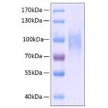 SDS-PAGE - Recombinant Human CD31 Protein (C-terminal His Tag) (A330311) - Antibodies.com