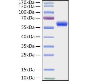 SDS-PAGE - Recombinant Human CD32 Protein (C-terminal Human Fc and His Tag) (A330312) - Antibodies.com