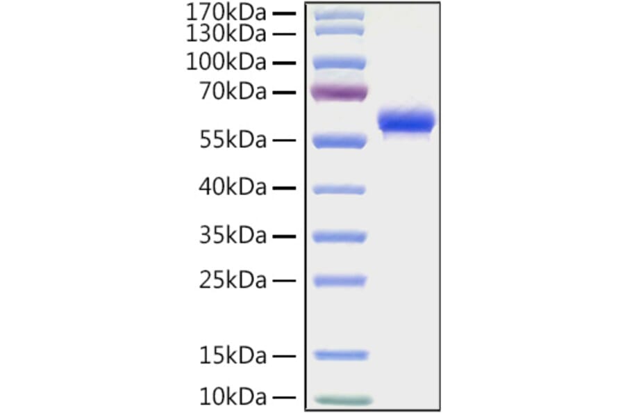 SDS-PAGE - Recombinant Human CD32 Protein (C-terminal Human Fc and His Tag) (A330312) - Antibodies.com