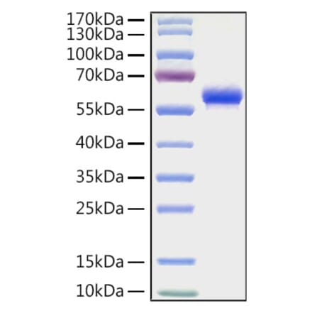 SDS-PAGE - Recombinant Human CD32 Protein (C-terminal Human Fc and His Tag) (A330312) - Antibodies.com