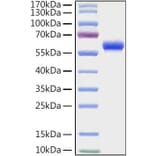 SDS-PAGE - Recombinant Human CD32 Protein (C-terminal Human Fc and His Tag) (A330312) - Antibodies.com