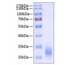 SDS-PAGE - Recombinant Human CD32 Protein (C-terminal His Tag) (A330313) - Antibodies.com