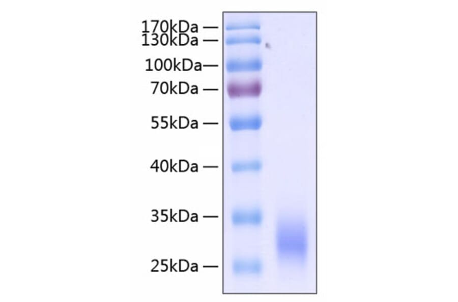 SDS-PAGE - Recombinant Human CD32 Protein (C-terminal His Tag) (A330313) - Antibodies.com