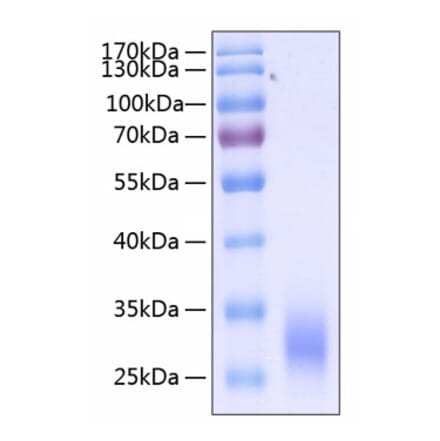 SDS-PAGE - Recombinant Human CD32 Protein (C-terminal His Tag) (A330313) - Antibodies.com