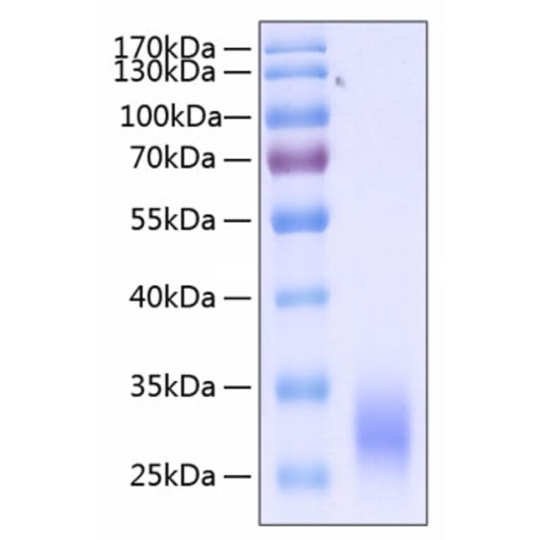 SDS-PAGE - Recombinant Human CD32 Protein (C-terminal His Tag) (A330313) - Antibodies.com