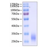 SDS-PAGE - Recombinant Human CD32 Protein (C-terminal His Tag) (A330313) - Antibodies.com