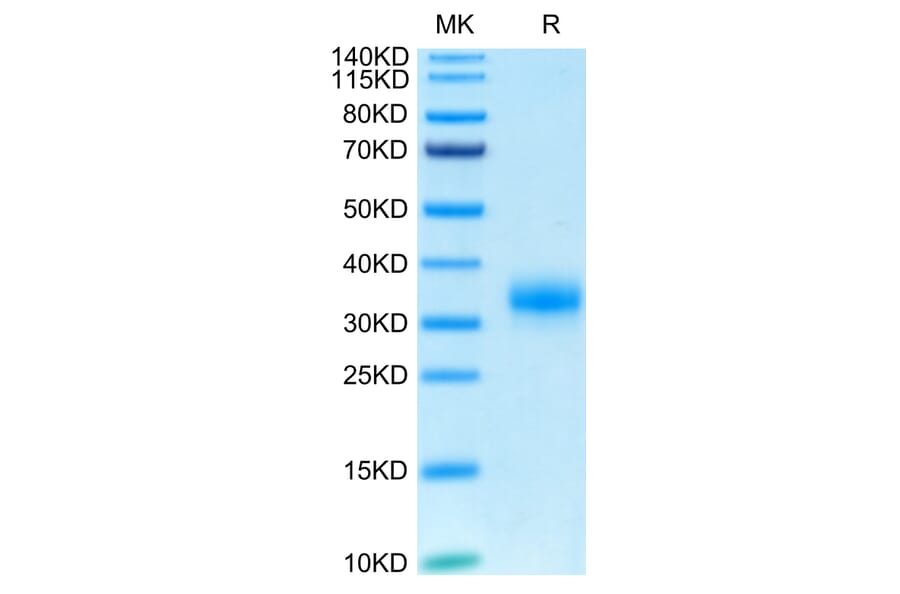 Tris-Bis PAGE - Recombinant Human CD32 Protein (Biotin) (C-terminal His and Avi Tag) (A330314) - Antibodies.com