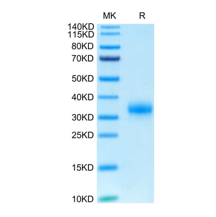 Tris-Bis PAGE - Recombinant Human CD32 Protein (Biotin) (C-terminal His and Avi Tag) (A330314) - Antibodies.com