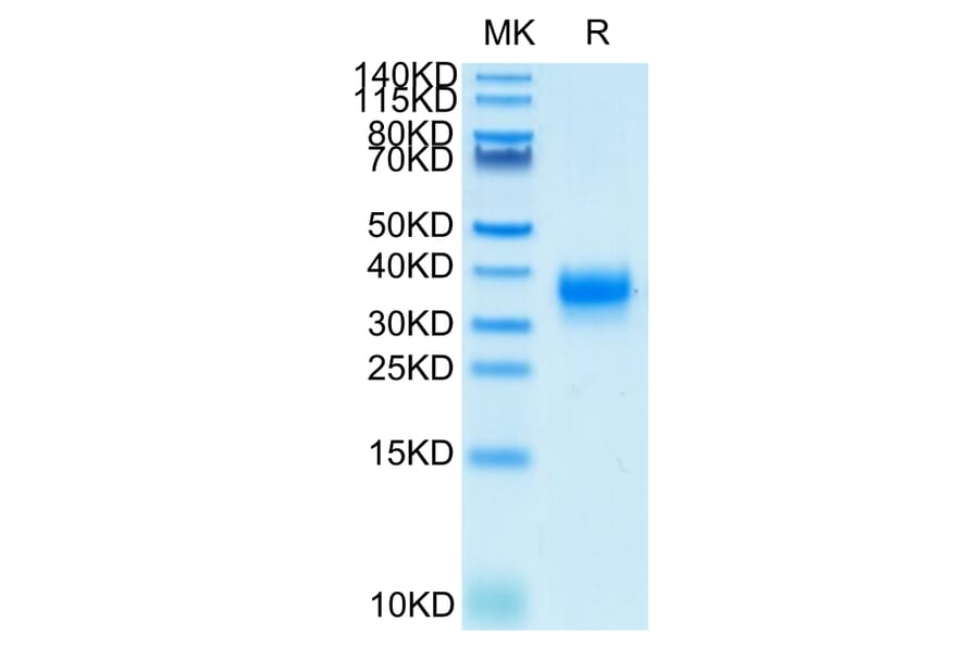 Tris-Bis PAGE - Recombinant Human CD32 Protein (Biotin) (C-terminal His and Avi Tag) (A330315) - Antibodies.com