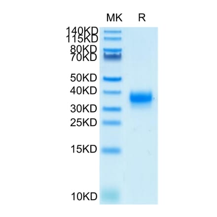 Tris-Bis PAGE - Recombinant Human CD32 Protein (Biotin) (C-terminal His and Avi Tag) (A330315) - Antibodies.com