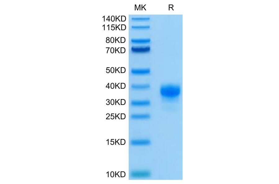 Tris-Bis PAGE - Recombinant Human CD32 Protein (C-terminal His and Avi Tag) (A330316) - Antibodies.com