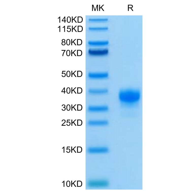 Tris-Bis PAGE - Recombinant Human CD32 Protein (C-terminal His and Avi Tag) (A330316) - Antibodies.com
