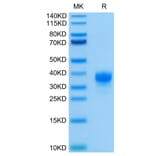Tris-Bis PAGE - Recombinant Human CD32 Protein (C-terminal His and Avi Tag) (A330316) - Antibodies.com