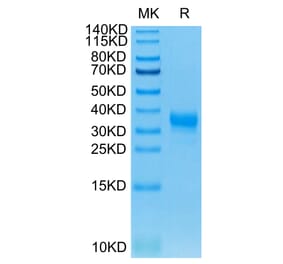 Tris-Bis PAGE - Recombinant Human CD32 Protein (C-terminal His and Avi Tag) (A330317) - Antibodies.com