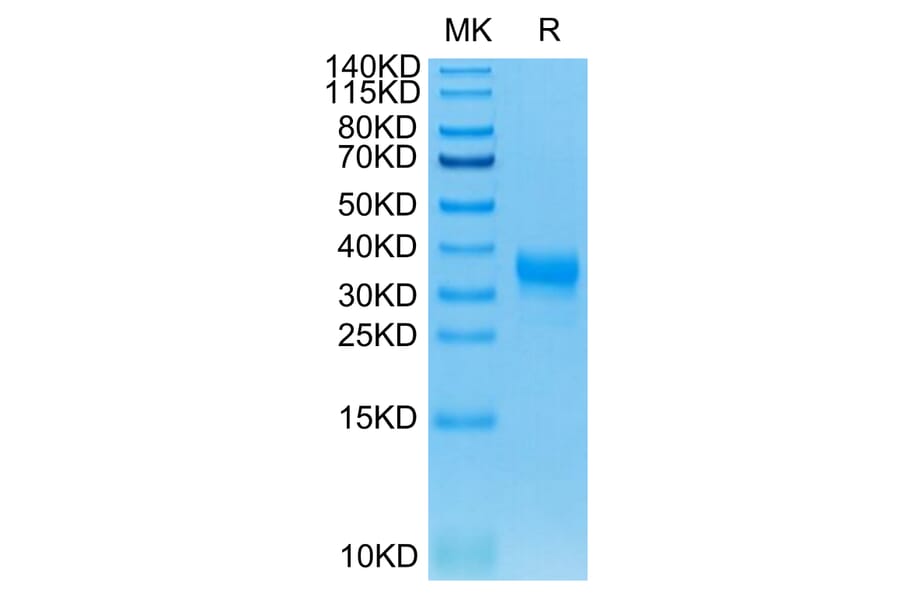 Tris-Bis PAGE - Recombinant Human CD32 Protein (C-terminal His and Avi Tag) (A330317) - Antibodies.com