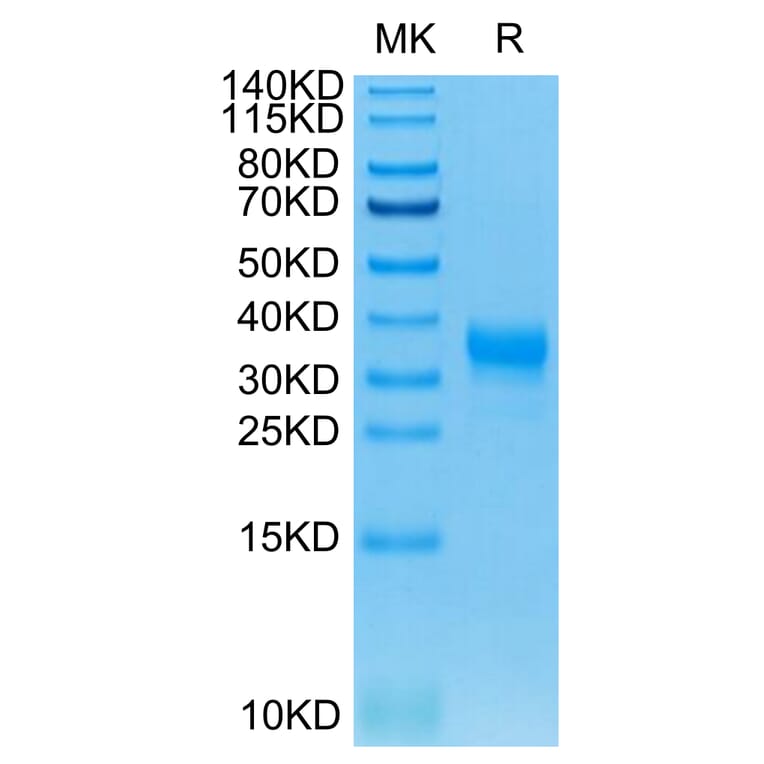 Tris-Bis PAGE - Recombinant Human CD32 Protein (C-terminal His and Avi Tag) (A330317) - Antibodies.com