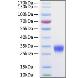 SDS-PAGE - Recombinant Human CD32 Protein (C-terminal His Tag) (A330318) - Antibodies.com