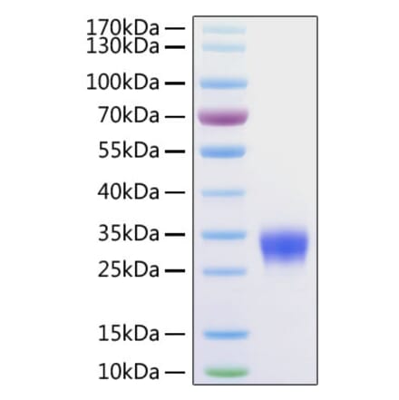 SDS-PAGE - Recombinant Human CD32 Protein (C-terminal His Tag) (A330318) - Antibodies.com